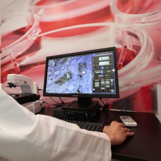 Salud: La tendencia indica que el cáncer se detecta en edades más tempranas