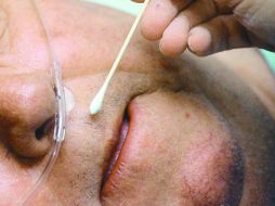 Han advertido que fumar y exponerse al vapor de sustancias tóxicas podrían desarrollar cáncer de nariz. AP / ARCHIVO