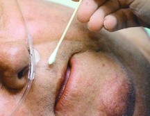 Han advertido que fumar y exponerse al vapor de sustancias tóxicas podrían desarrollar cáncer de nariz. AP / ARCHIVO