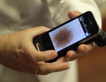Los lunares se clasifican de acuerdo a su aspecto, con las características observadas al microscopio y su origen. AFP / ARCHIVO