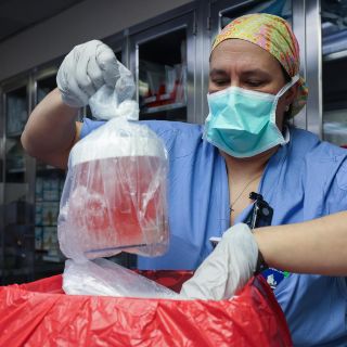 Muere la primera persona en recibir un riñón de cerdo genéticamente modificado