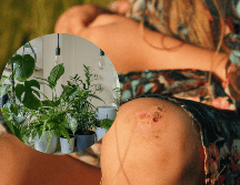 Esta desconocida planta para muchos cuenta con propiedades medicinales capaces de sanar heridas de la piel. UNSPLASH/ Klara Kulikova/ vadim kaipov