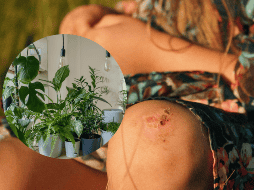 Esta desconocida planta para muchos cuenta con propiedades medicinales capaces de sanar heridas de la piel. UNSPLASH/ Klara Kulikova/ vadim kaipov