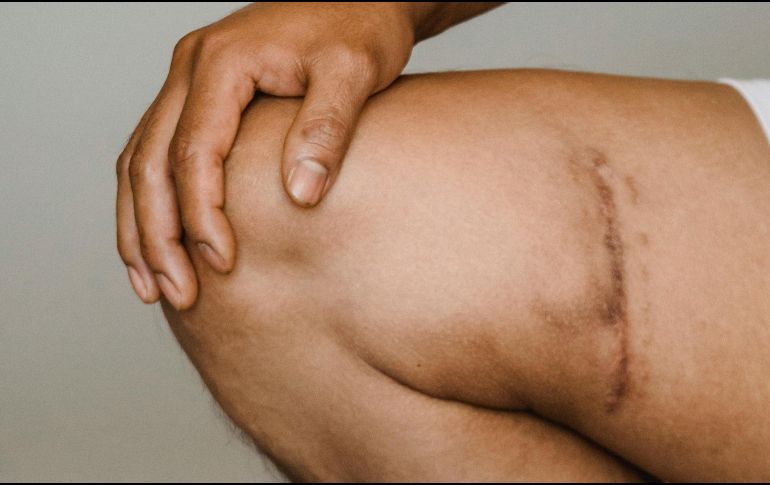 El consumo de estas frutas ayudará a acelerar el proceso de cicatrización. ESPECIAL/Foto de Armin  Rimoldi en Pexels