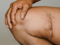 El consumo de estas frutas ayudará a acelerar el proceso de cicatrización. ESPECIAL/Foto de Armin  Rimoldi en Pexels