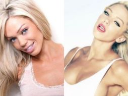 A Loni se le encontró sin varias piezas dentales y, comúnmente, es captada con moretones alrededor de sus brazos o rostro. ESPECIAL