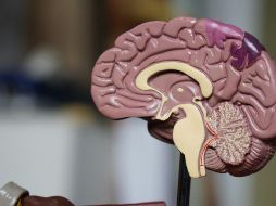 Las enfermedades neurodegenerativas, como el Alzheimer y el Parkinson, representan uno de los mayores desafíos de salud pública a nivel mundial. Unsplash.