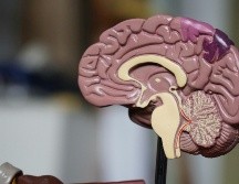 Las enfermedades neurodegenerativas, como el Alzheimer y el Parkinson, representan uno de los mayores desafíos de salud pública a nivel mundial. Unsplash.