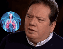 Esta enfermedad puede variar en gravedad, desde síntomas leves hasta casos más severos. INSTAGRAM/ coquemuñiz/ ESPECIAL