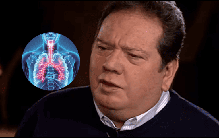 Esta enfermedad puede variar en gravedad, desde síntomas leves hasta casos más severos. INSTAGRAM/ coquemuñiz/ ESPECIAL