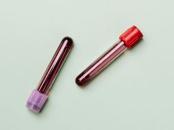 La concesión de esta licencia sanitaria es solo el primer paso en el proceso de producción nacional de estos medicamentos. Pexels