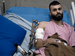 Mujahid Abadi recuperándose en el Hospital Especializado de Ibn Sina el martes 25 de junio del 2024. AP / M. ALLERUZZO