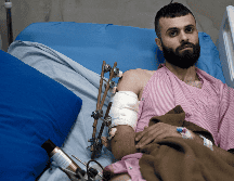 Mujahid Abadi recuperándose en el Hospital Especializado de Ibn Sina el martes 25 de junio del 2024. AP / M. ALLERUZZO