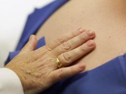 Ante la disminución en la producción natural de colágeno, las especialistas recomendarán suplementos específicos. AFP / ARCHIVO