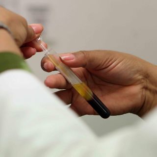 Estos hombres deben hacerse el examen de la próstata antes que la mayoría