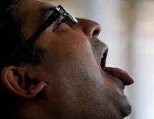 Se trata de un padecimiento muy sencillo de prevenir, pues no se requiere de ningún tratamiento caro, sino de llevar a cabo las recomendaciones usuales de una o un experto en odontología. AFP / ARCHIVO