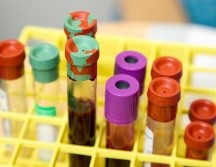 La OMS recomendó que el medicamento sea accesible en todo el mundo. UNSLASH / NCI