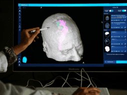 Investigadores de institutos Feinstein de Investigación Médica se propuso averiguar los efectos del sexo y el género en la actividad de las redes cerebrales. EFE/ ARCHIVO