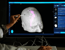 Investigadores de institutos Feinstein de Investigación Médica se propuso averiguar los efectos del sexo y el género en la actividad de las redes cerebrales. EFE/ ARCHIVO