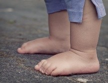 Un edema es la hinchazón causada por el exceso de líquido atrapado en los tejidos del cuerpo y, por lo general, hay más probabilidades de que aparezca en las piernas y los pies. PIXABAY/ FeeLoona