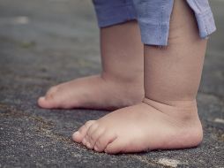 Un edema es la hinchazón causada por el exceso de líquido atrapado en los tejidos del cuerpo y, por lo general, hay más probabilidades de que aparezca en las piernas y los pies. PIXABAY/ FeeLoona