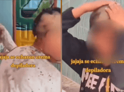 Aparentemente este suceso se debió a un ingenuo error, al confundir champú para el cabello con un tratamiento depilatorio. ESPECIAL.