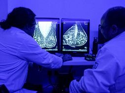 El cáncer de mama es una enfermedad donde se desarrollan células malignas en los tejidos de la mama. EL INFORMADOR / ARCHIVO