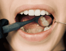 El momento en que decides cepillarte los dientes y tus hábitos diarios juegan un papel crucial en la salud del esmalte dental y el color de tus dientes. CANVA