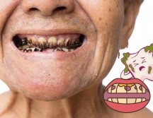 La acumulación de placa, caries, enfermedades periodontales y problemas de salud sistémica son solo algunos de los problemas que pueden surgir. CANVA