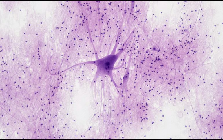 Compararon esferoides neuronales generados a partir de pacientes con diferentes tipos de alzheimer. UNSPLASH / BILFR