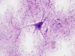 Compararon esferoides neuronales generados a partir de pacientes con diferentes tipos de alzheimer. UNSPLASH / BILFR