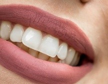 Usar pastas dentales no industriales son una excelente opción para las personas que sufren de padecimientos bucales, como la gingivitis. UNSPLASH/ Tony Litvyak