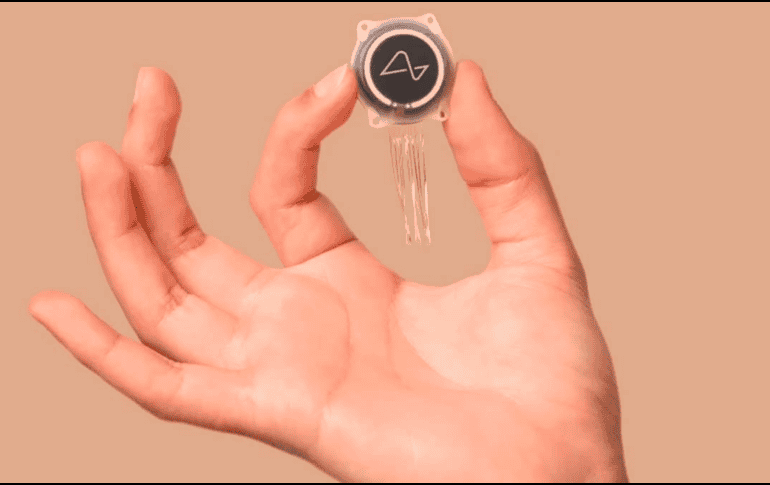 El implante registra la actividad neuronal y envía señales a un dispositivo externo a través de bluetooth. ESPECIAL / NEURALINK