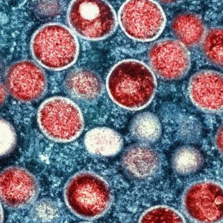 Virus Mpox: ¿Cuántos casos y muertes se registran en África?
