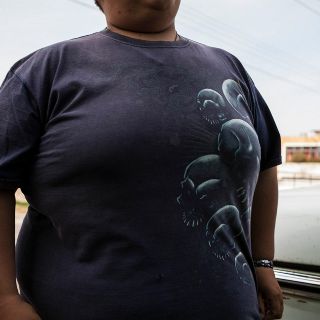 Manchas oscuras en el cuello de los niños, una señal de alarma