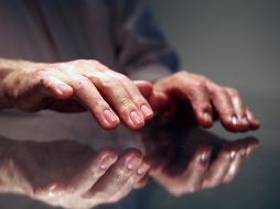 Esta fruta no solo ayuda a mantener la piel firme y elástica, sino que también acelera la cicatrización de heridas y reduce la formación de cicatrices. AP / ARCHIVO