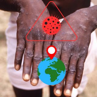 Detectan primer caso de mpox fuera de África, ¿dónde?