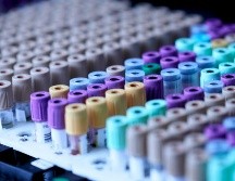 Los investigadores desarrollaron un sistema experimental, basado en líneas celulares humanas. UNSPLASH / TESTALIZE