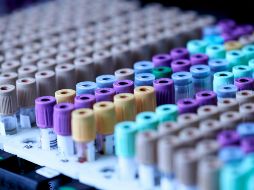 Los investigadores desarrollaron un sistema experimental, basado en líneas celulares humanas. UNSPLASH / TESTALIZE