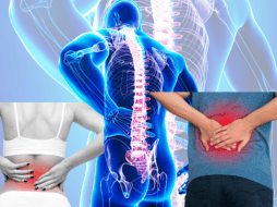 Aunque los cuadros clínicos de dolor de espalda suelen presentarse entre los 45 y 65 años, un alto porcentaje de estudiantes también lo manifiestan. CORTESÍA/ Centro Médico ABC/ ESPECIAL