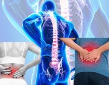 Aunque los cuadros clínicos de dolor de espalda suelen presentarse entre los 45 y 65 años, un alto porcentaje de estudiantes también lo manifiestan. CORTESÍA/ Centro Médico ABC/ ESPECIAL