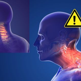 Estos son los riesgos REALES para la salud de tronarse el cuello