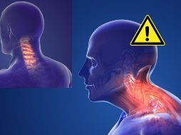 Aunque tronarse el cuello puede proporcionar un alivio temporal para algunas personas, los riesgos reales asociados con esta práctica deben ser considerados cuidadosamente. 
 CANVA
