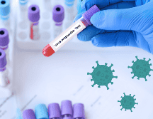 No existen vacunas para prevenir la infección ni medicamentos para tratar los síntomas. CANVA