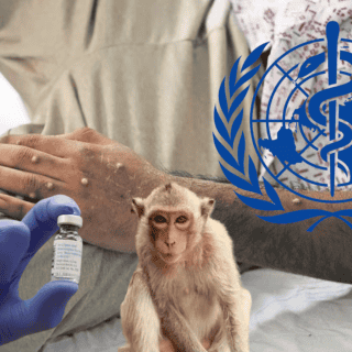 La OMS asegura que el brote de mpox podría "terminar en 6 meses"