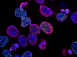 El estudio apunta a la intervención en los procesos de envejecimiento celular. UNSPLASH / NCI