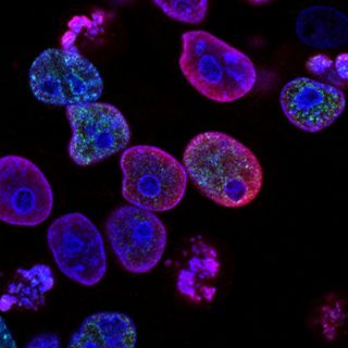 Estudio revela el vínculo entre el envejecimiento celular y enfermedades crónicas