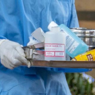 Cuatro nuevos casos de mpox son detectados en México