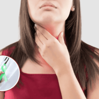 ¿Cómo identificar los primeros síntomas del linfoma, previos al diagnóstico?