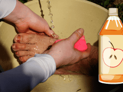 Los trastornos en los pies se evidencian en la piel como callos, juanetes, ampollas, sequedad cutánea o exceso de transpiración. NTX / ARCHIVO